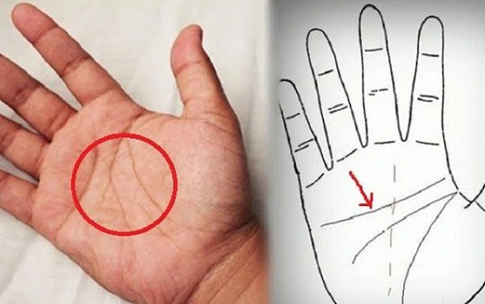 Đường Chỉ Tay Hình Chữ M