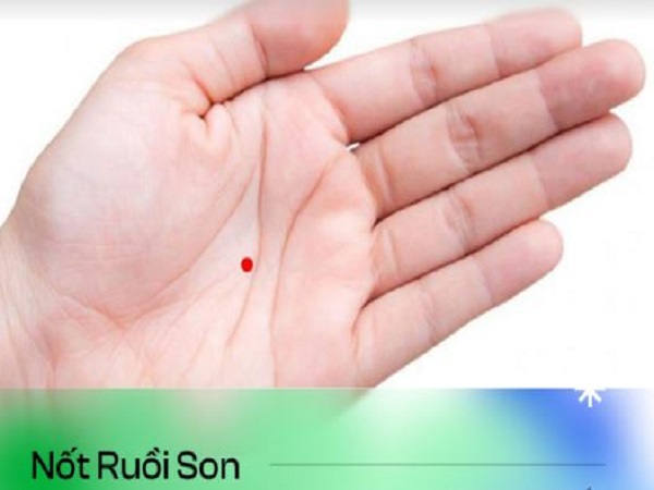 Ý nghĩa nốt ruồi son ở lòng bàn tay trái nữ